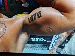 UFC '핵이빨' 논란...타이슨을 소환하다 [이석무의 파이트 클럽]