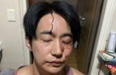 전호준 “연인 폭행 아닌 정당방위···강경대응할 것”