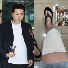 ‘태진아 아들’ 이루, 음주운전 자숙 중 건강 적신호 “몸도 마음도 만신창이”
