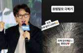박성광, 원형탈모 극복 中... “감사해요 원장님” 울컥