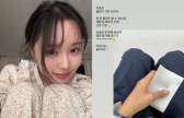 "혈관 거의 녹아"…'박성광 부인' 이솔이, 여성암 투병기