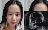‘최현석 딸’ 최연수, 子 초음파에 할아버지 얼굴이... “자꾸 누가 생각나”