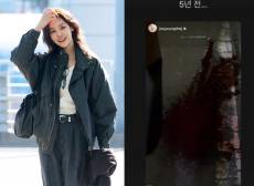 “1시간 넘게 안 멈춰”…‘활동 중단’ 차주영, 심각·반복 비출혈 증상 공개