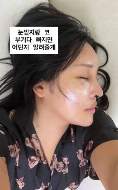 랄랄, 눈밑지방 재배치+코 재수술 성공... 달라진 옆태 [IS하이컷]