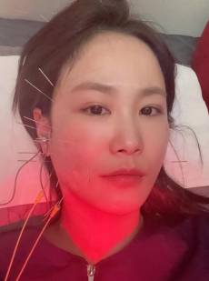 김지민, 욕실 낙상사고 후유증... “피부가 ‘콕’ 함몰” [IS하이컷]