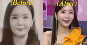 ‘쌍수 4번’ 장영란, 여권사진 공개.. “좀 달라지긴 했다” 자폭 (A급 장영란)