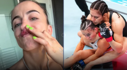 “내가 죽은 것처럼 보인다, 지금처럼 살아 있어서 감사” UFC 섬뜩 장면 주인공, 드디어 입 열었다