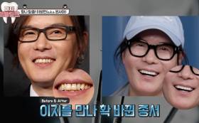 김종서, ‘닥터이지’ 이빨토크 출연…음악 인생부터 최근 변화까지 진솔한 대화